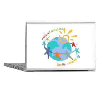 Advocate Gifts  Advocate Laptop Skins  Autism Awareness